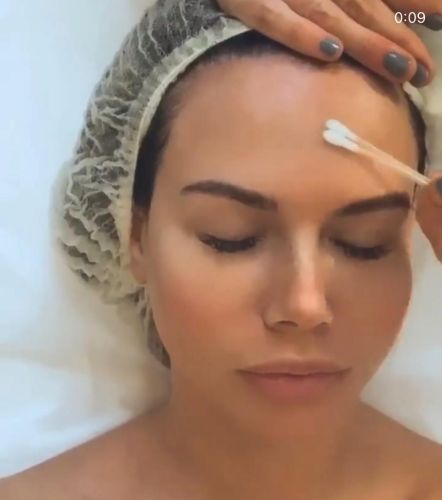 пилинг услуги